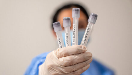 Hantavirus
