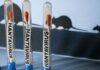Ministerio de Salud confirmó tres fallecidos por Hantavirus en Anzoátegui 9 Ministerio