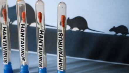 Ministerio de Salud confirmó tres fallecidos por Hantavirus en Anzoátegui 2 Ministerio