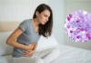 Ciclosporiasis