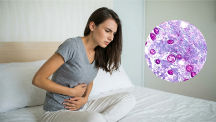 Ciclosporiasis