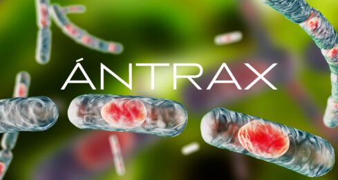 ántrax
