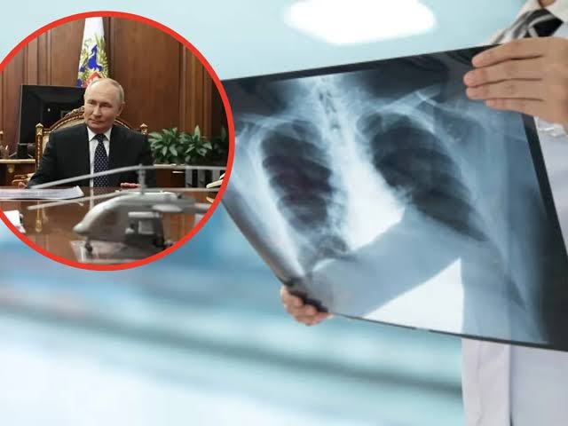 Peste Rusia