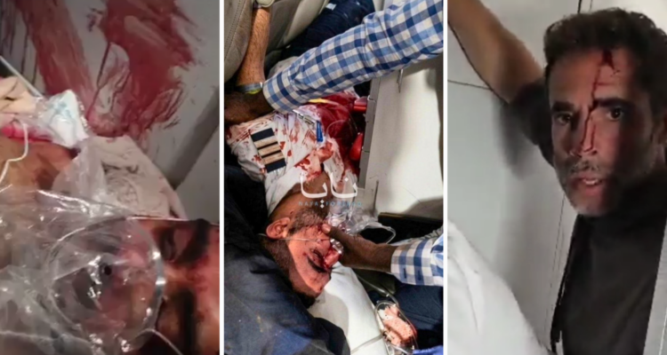 Salen a la luz nuevas violaciones de seguridad en el caso del avión de FlyDubai (Hay video) 1 FlyDubai